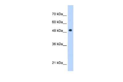 Adiponutrin Pnpla Antibody Nbp Novus Biologicals