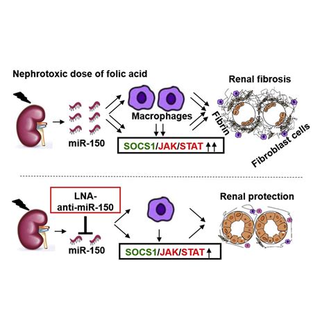 MiR 150 Based RNA Interference Attenuates Tubulointerstitial Fibrosis