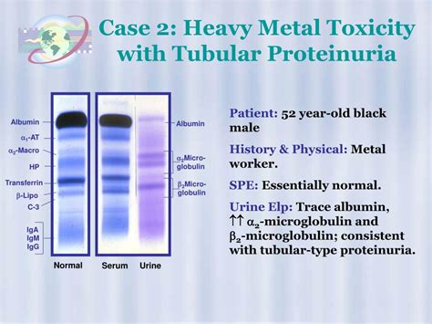 Ppt High Resolution Protein Electrophoresis Powerpoint Presentation Free Download Id 298130