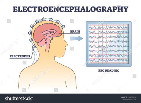 Lectroenc Phalographie Ou Eeg Comme Sch Ma De Image Vectorielle De