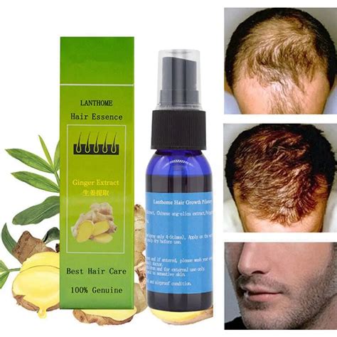 Buy Professional Anti Hair Loss Hair Growth Liquid Spray For Women Men Hair