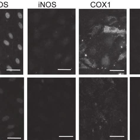 Representative Microphotographs Of Immunohistochemical Images Of Ecnos