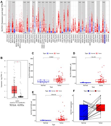 Slc A Is A Prognostic Biomarker In Ucec Ijgm