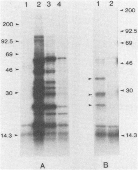 Comparisons Of Immunoprecipitations Of 35s Methionine Labeled In Vitro