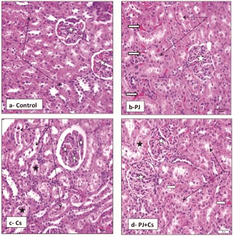 Renal Cortex Histology