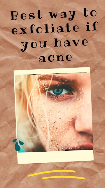 Should you exfoliate Acne Prone Skin