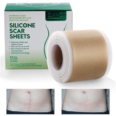 Buy Away Silicone Sheets Removal Tape Medical Grade Silicone Strips For Acne C Section Burn