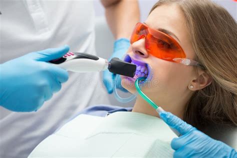 Tooth Filling Ultraviolet Lamp Stock Photo Image Of Examination