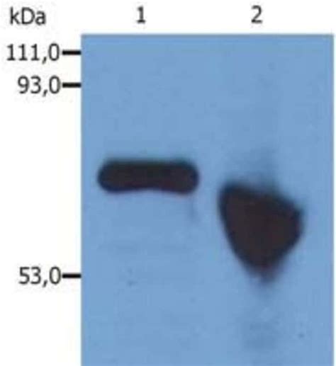 AFP Monoclonal Antibody AFP 01 Invitrogen 100 μg Unconjugated