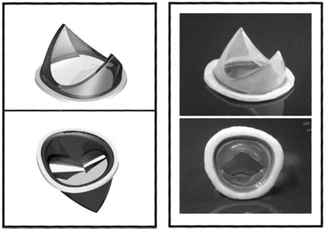 Introduction Of A Flexible Polymeric Heart Valve Prosthesis With Special Design For Mitral