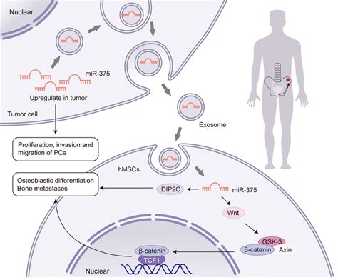 The Mechanism Scheme Of Exosomal Mir Promoting Pca Progression And