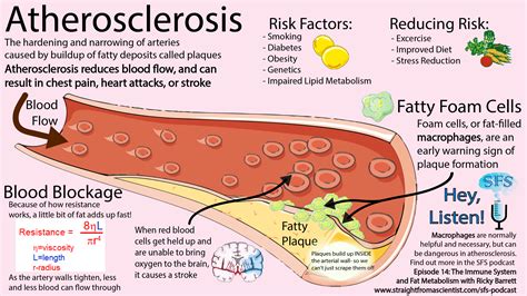 A Quick Rundown On Atherosclerosis Or The Hardening Of Arteries Due To