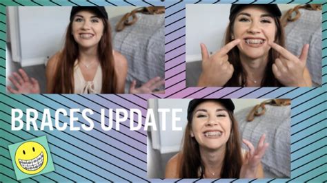 BRACES UPDATE Let S Talk YouTube