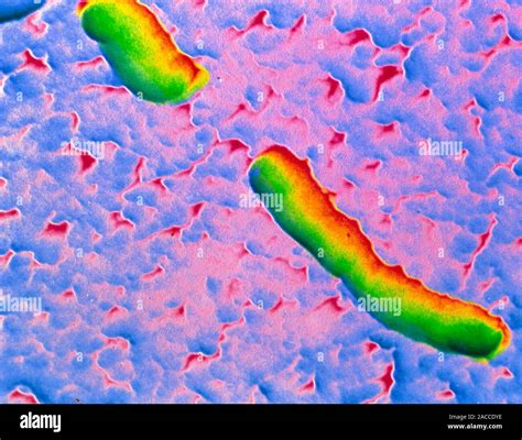 Falso Color An Lisis Micrograf A De Electrones Sem De Haemophilus