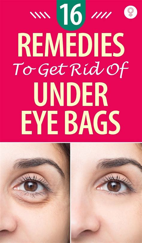 16 Home Remedies To Get Rid Of Eye Bags Artofit