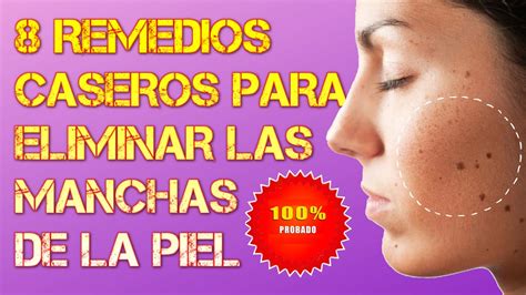 Remedios Caseros Para Eliminar Las Manchas De La Piel Youtube