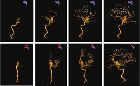 Four Dimensional Dsa Reconstruction From A 3d Dsa Reconstruction