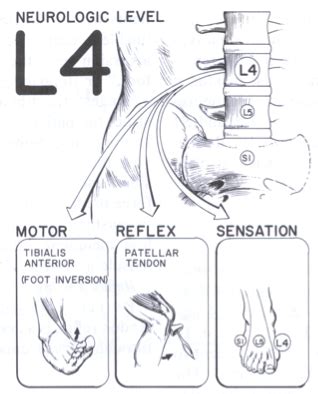 Lumbar Spine Flashcards Quizlet