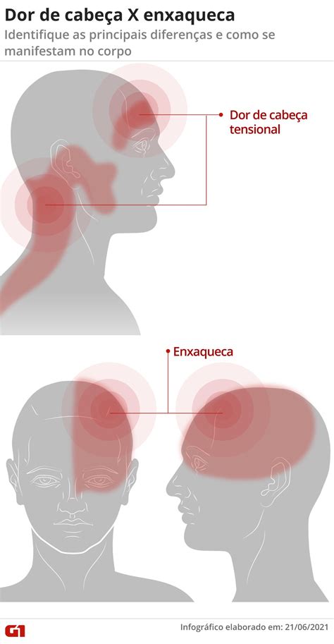 Existe Uma Diferenca Sintomas Da Enxaqueca Enxaqueca Tipos De Dor De