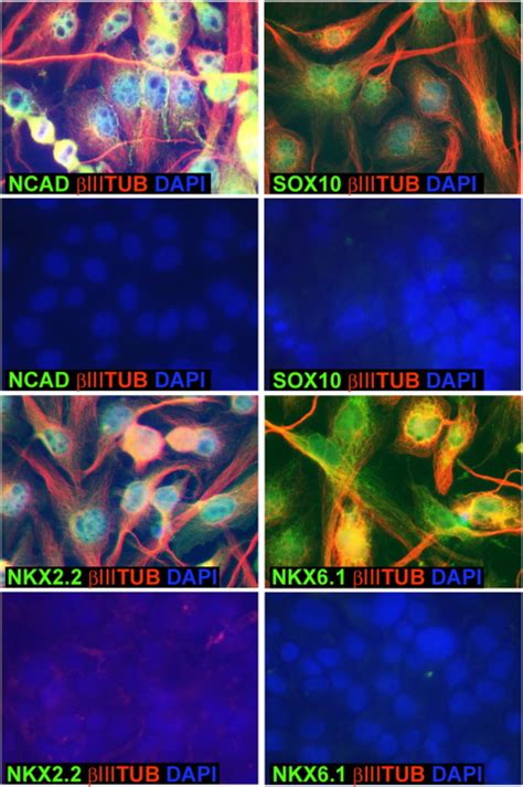 Immunocytochemical Confirmation Of Expression Of Some DMSO Responsive