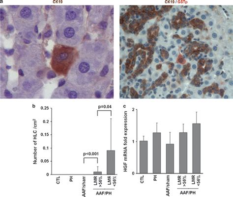 Rare Signs Of Hepatic Differentiation Of Liver Progenitor Cells Lpc Download Scientific