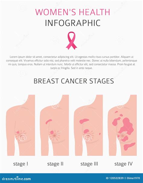 Cancro Al Seno Infographic Medico Sistemi Diagnostici Sintomi