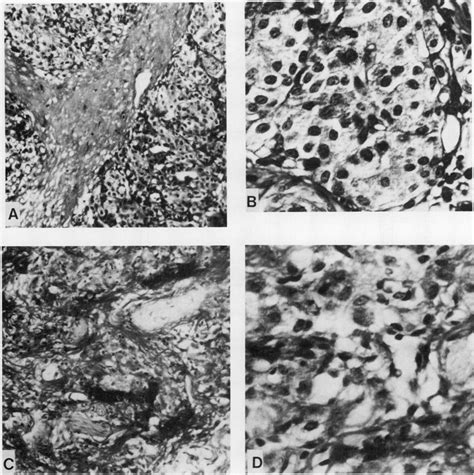 Photomicrographs Of Masson Trichrome Stained Sections Ofa And B An