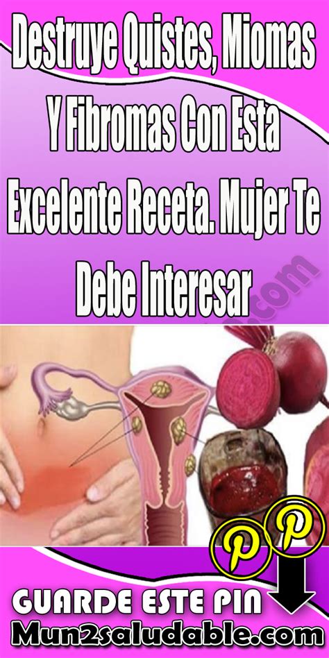 Destruye Quistes Miomas Y Fibromas Con Esta Excelente Receta Mujer Te