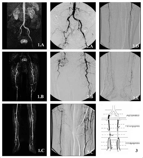 The Results Of The Contrast Enhanced Magnetic Resonance Angiography Download Scientific Diagram