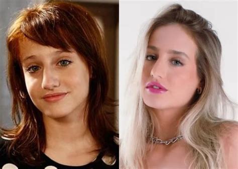 Bruna Do Bbb Antes E Depois Saiba Procedimentos Est Ticos Que Bruna