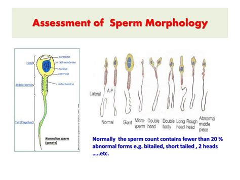 Ppt Semen Analysis Powerpoint Presentation Free Download Id3003130