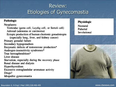 Ppt Gynecomastia Powerpoint Presentation Free Download Id 3336596