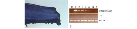 Ectopic Noggin Expression And Decay Following Heat Shock In N1