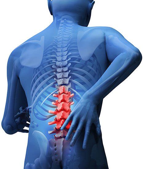 Thoracic Spine Pain Relief - Acute & Chronic Pain and Spine Center - Amarillo, TX