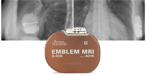 EMBLEM MRI S ICD System Implant Procedure Boston Scientific