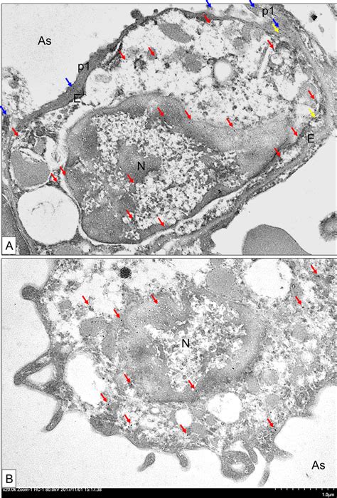 The Immuno Gold Electron Micrographs For The Expression Of Lsp In The