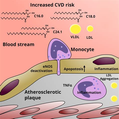 Ceramide Metabolism In Cardiovascular Disease A Network With High