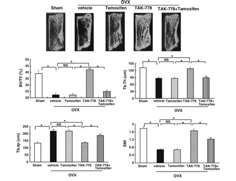 Micro Computed Tomography Scanning Of Lumbar Vertebrae In OVX Rats