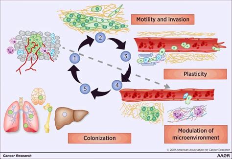 Aacr Virtual Annual Meeting Ii Insights Into Cancer Metastasis Reveal