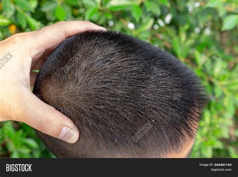 Close Skin Head Image And Photo Free Trial Bigstock