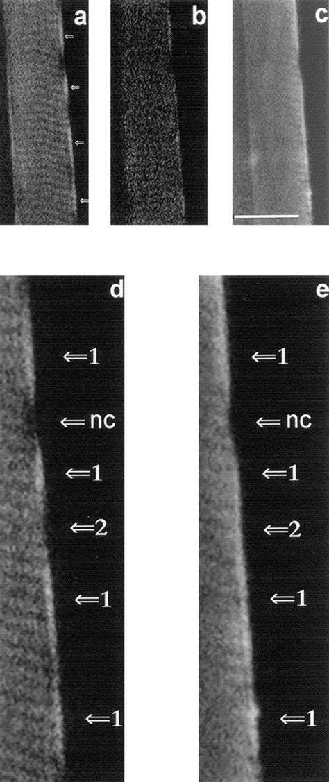 Confocal Laser Scanning Micrographs Illustrating Topological Subsets Of