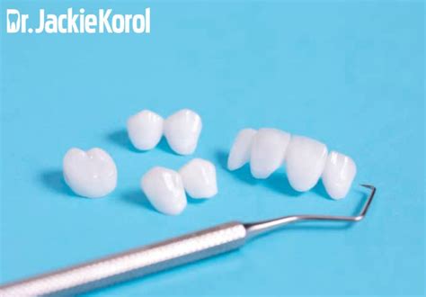 What To Do If Your Dental Crown Falls Off Calgary Dentist Dr Korol