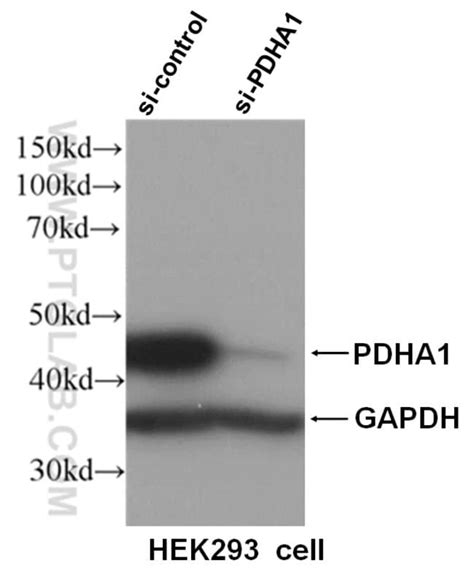 Pdh E Alpha Rabbit Anti Human Mouse Rat Polyclonal Proteintech