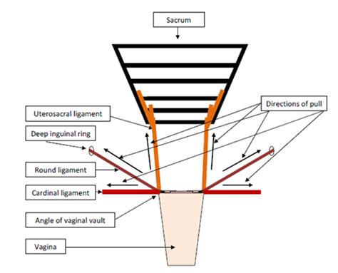 Diagram Of Uterosacral Ligaments