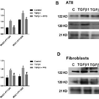 Pirfenidone PFD supresses the TGF β1 induced MUC1 cytoplasmic tail