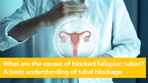 Blocked Fallopian Tubes Symptoms Causes And Treatments