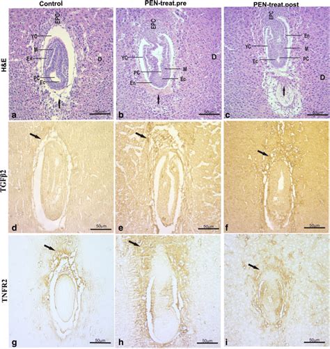 Photomicrographs Of Sagittal Sections Hande Stain Through A Cylindrical Download Scientific