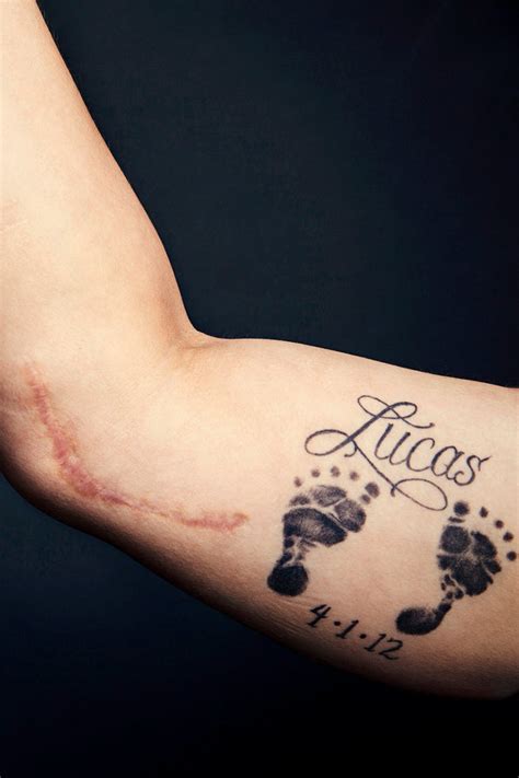 With Tommy John Surgery Every Scar Tells A Story The New York Times