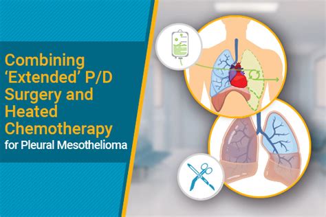 Epd Surgery And Heated Chemo For Pleural Mesothelioma