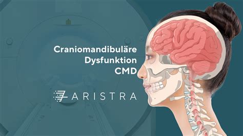 Craniomandibuläre Dysfunktion CMD Ursachen Diagnose und Behandlung